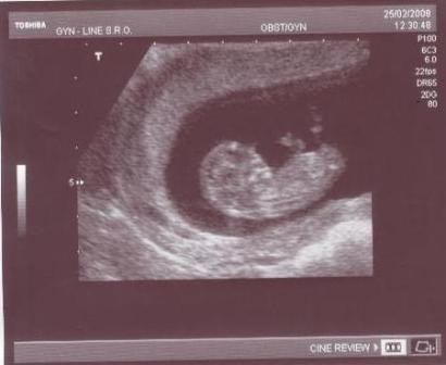 uprost�ed treninku